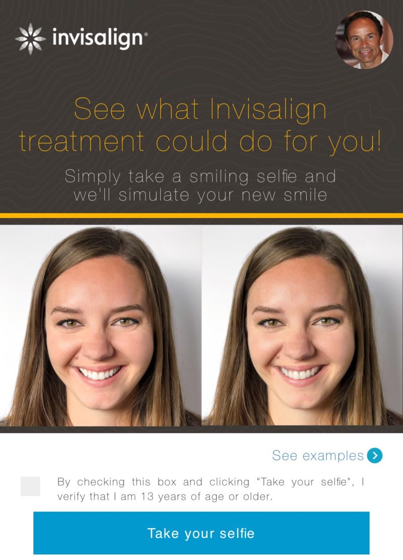 Invisalign Mobile App Before and after